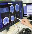 Close-up de uma médica analisando o laudo de uma tomografia computadorizada em um monitor de computador  Foto: Getty Images / BBC News Brasil