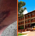 UFRPE é condenada a pagar R$ 10 mil a estudante atacado por cães em universidade  Foto: Reprodução/Divulgação / Portal de Prefeitura