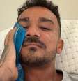 Ressonância de Danilo com os pinos alocados em seu rosto após operação –  Foto: Reprodução / Instagram / Jogada10