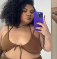 Antes e depois de Flora Cruz após perder 44 kg  Foto: Reprodução/Instagram