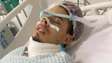 Homem vai para UTI após tirar siso em faculdade da Unesp: 'Gritava de dor'