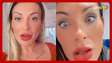 Andressa Urach relata ‘dor’ e ‘medo de ficar cega’ após cirurgia para mudar cor dos olhos