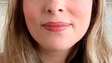Síndrome geniturinária da menopausa