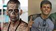 Homem que já foi o mais tatuado do Brasil mostra rosto após retirar tatuagens: ‘Dignidade devolvida’