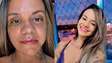 Vítima de 61 socos do ex-namorado mostra recuperação após cirurgia facial e recebe apoio nas redes