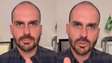 Eduardo Bolsonaro se pronuncia pela primeira vez após cassação: ‘Medalha de honra'