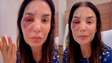 ‘Houve uma ruptura de osso’, diz Ivete Sangalo sobre cirurgia que fez no rosto após queda no banheiro