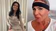 Gretchen atualiza recuperação após transplante capilar: ‘Olha como estou bem’