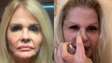 Monique Evans mostra resultado uma semana após rejuvenescimento facial: 'Novo rosto'
