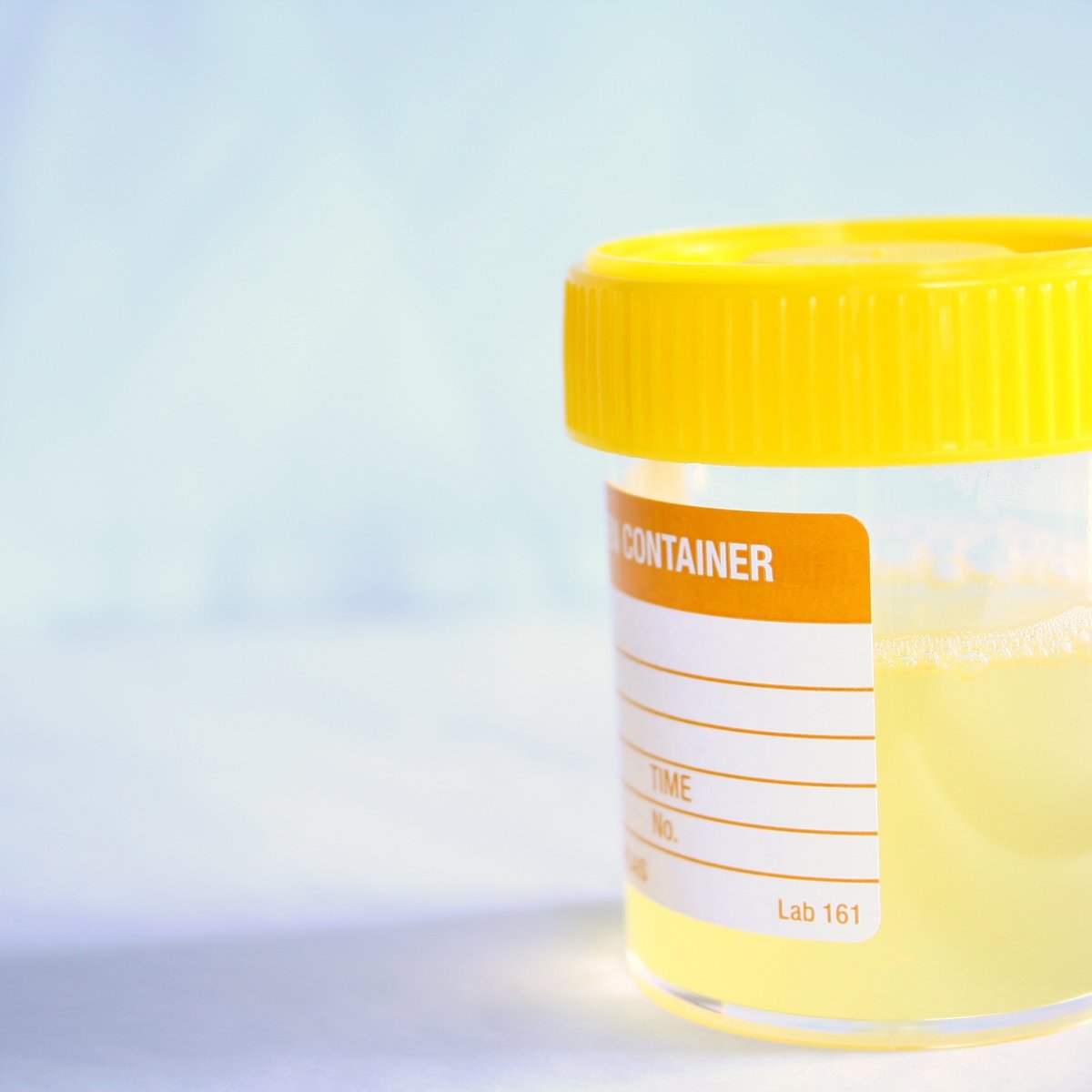 Infeccao Urinaria Tire 10 Duvidas Sobre O Problema