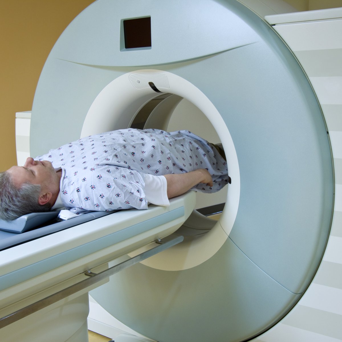 Radioterapia Cancer Prostata Efeitos Colaterais Donde Sale La