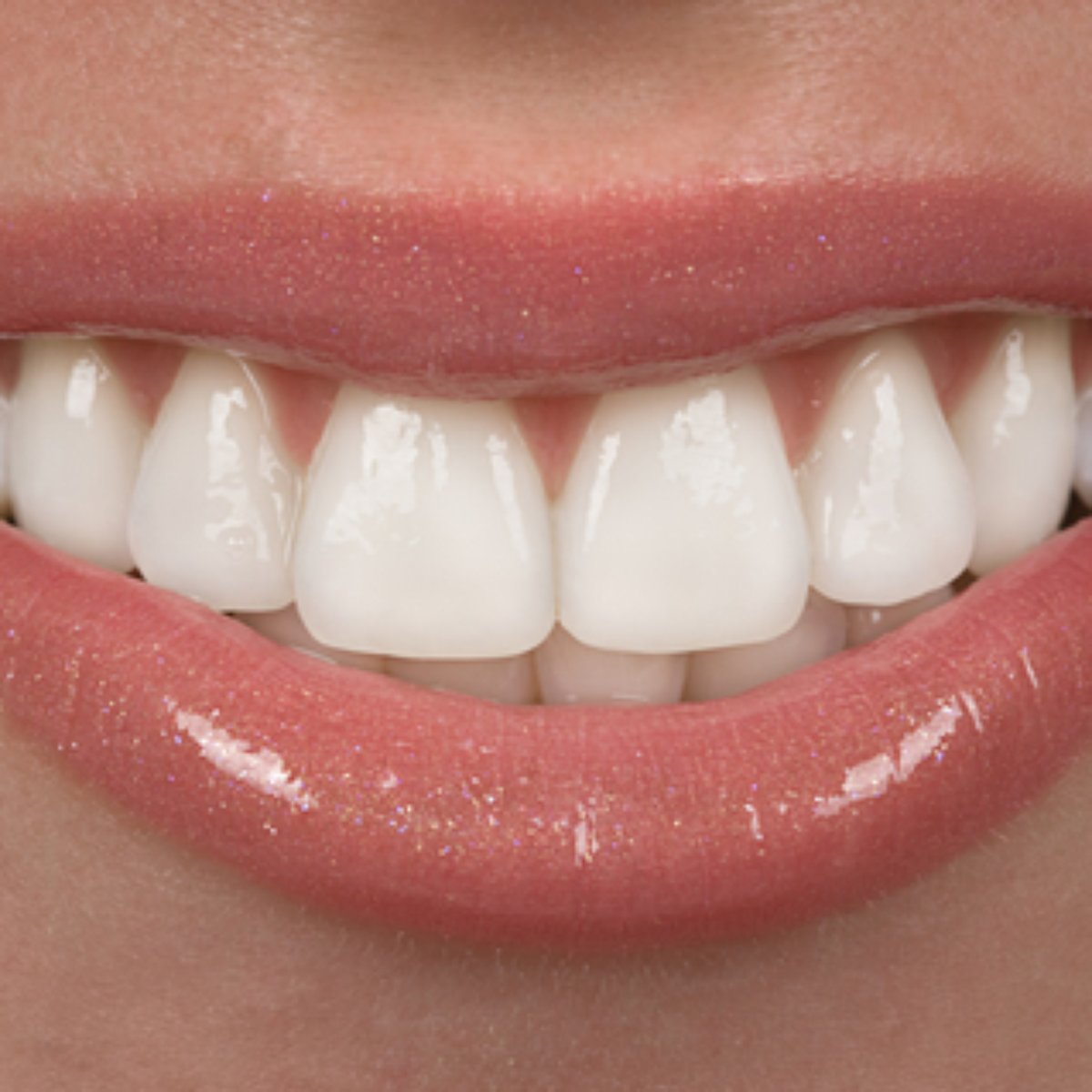 Faceta De Porcelana Sorriso De Celebridade Em 6 Horas 21 отметок «нравится», 0 комментариев — leão excelência em saúde (@leaosaude) в instagram: faceta de porcelana sorriso de