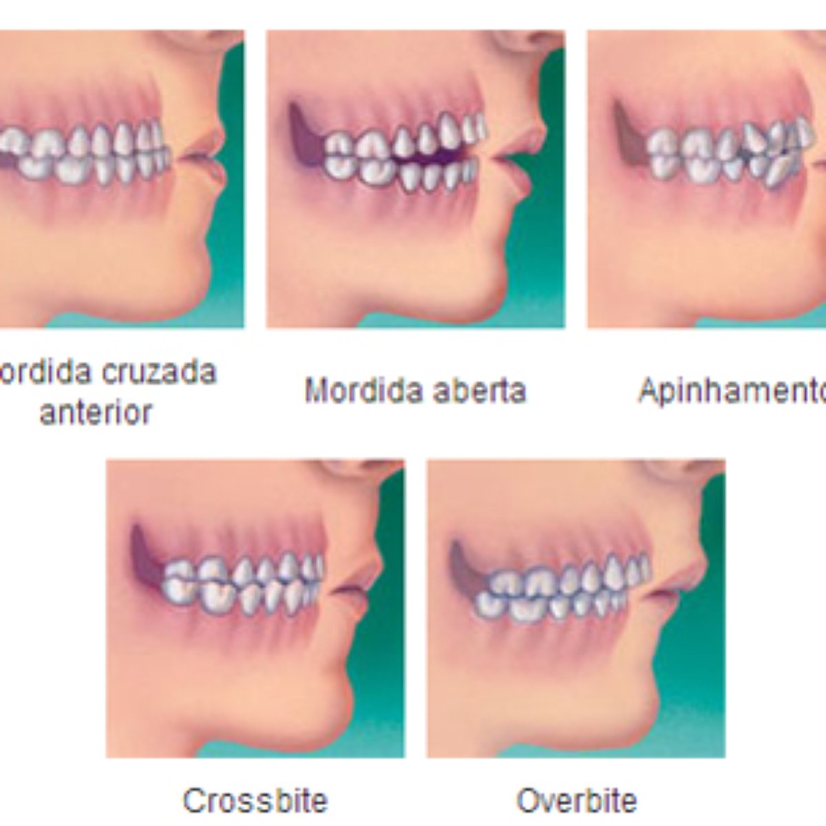 Entenda O Que E Ortodontia