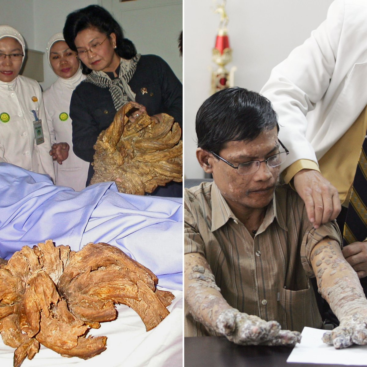 Doencas Raras Veja Fotos De Casos Em Todo O Mundo