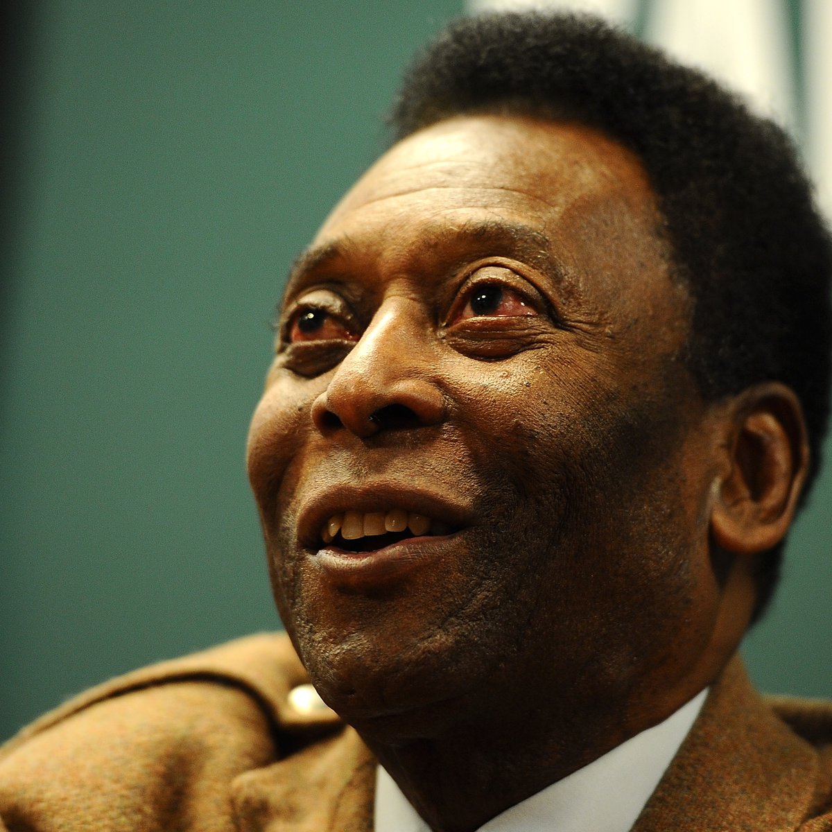 Internautas Se Assustam Com Piora De Pele Morreu