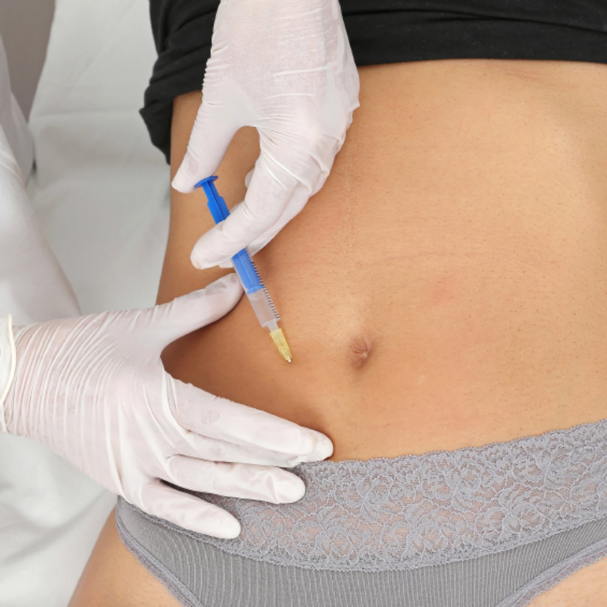 Antes E Depois De Aplicar Enzimas Na Barriga Hidrolipoclasia Mais Um Tratamento Contra As Gordurinhas