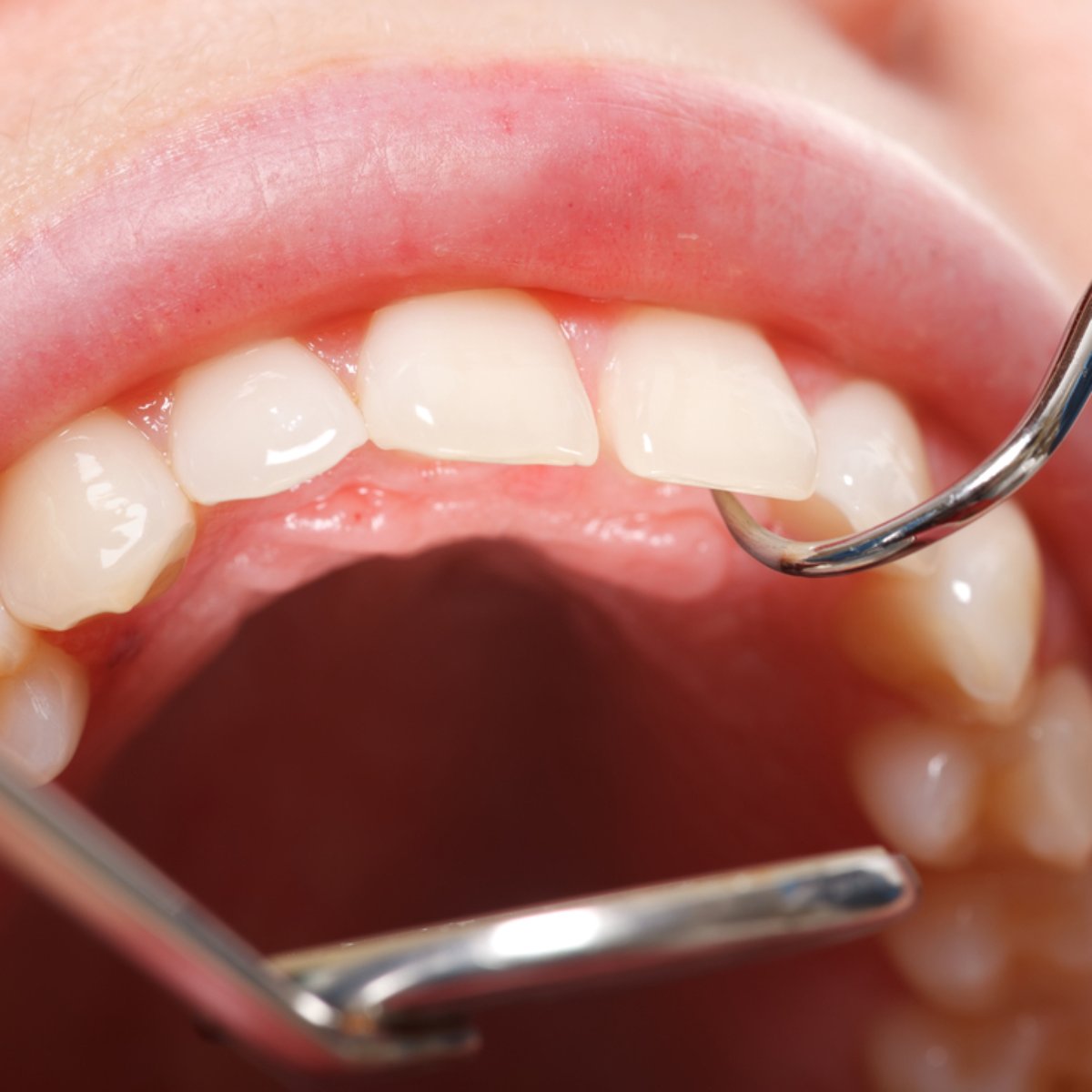 o dentista faz e voce nem imagina