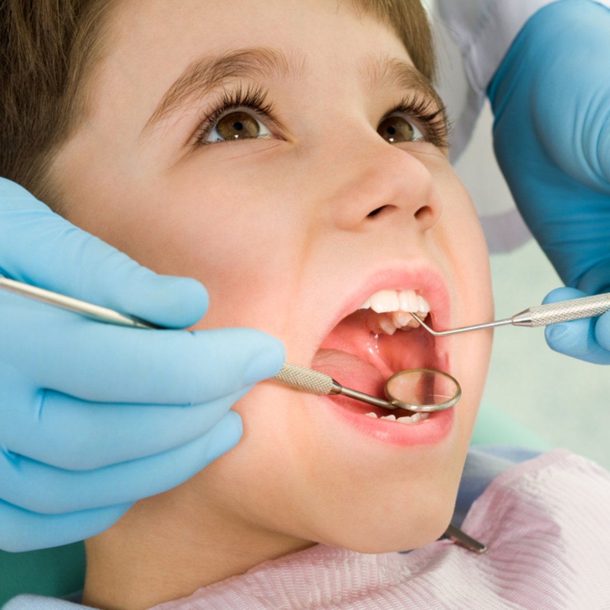 Você sabe o que é a massinha do dentista?