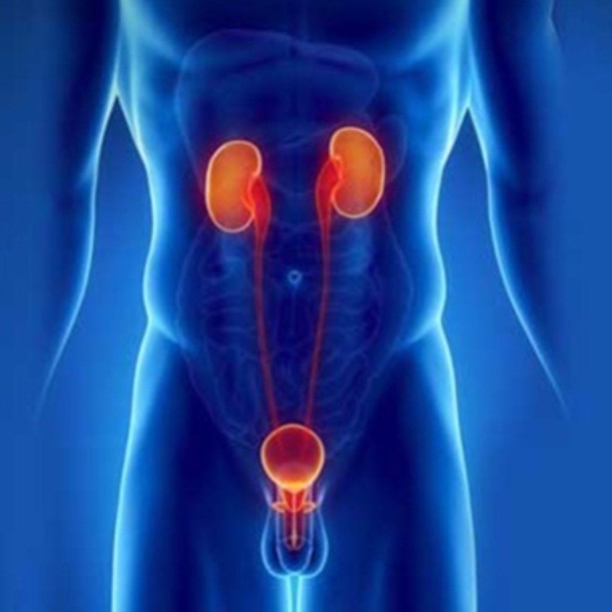 obstrucao urinaria em homens especialista explica as causas sintomas e tratamentos