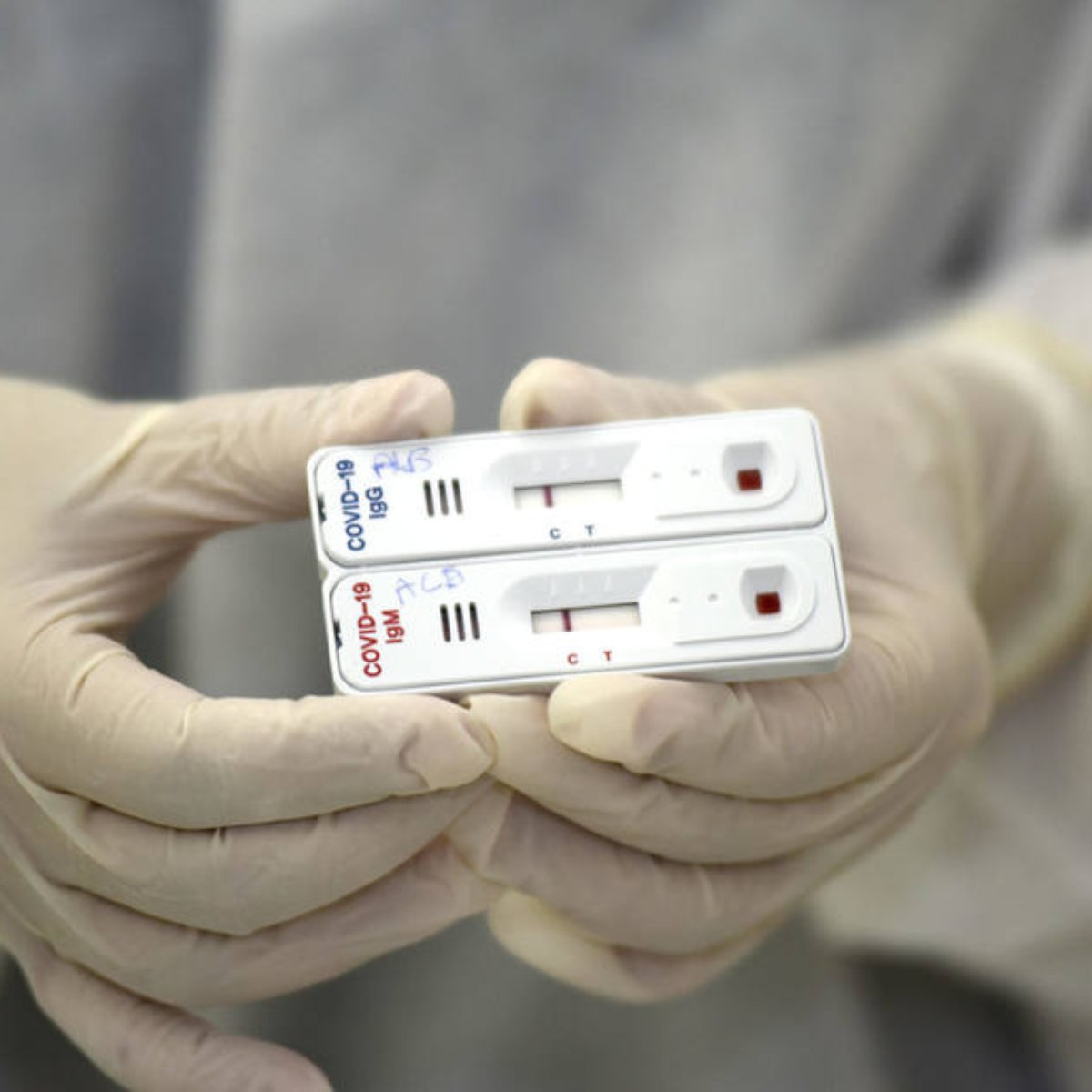 Covid-19: 15% dos testes rápidos de farmácia dão positivo