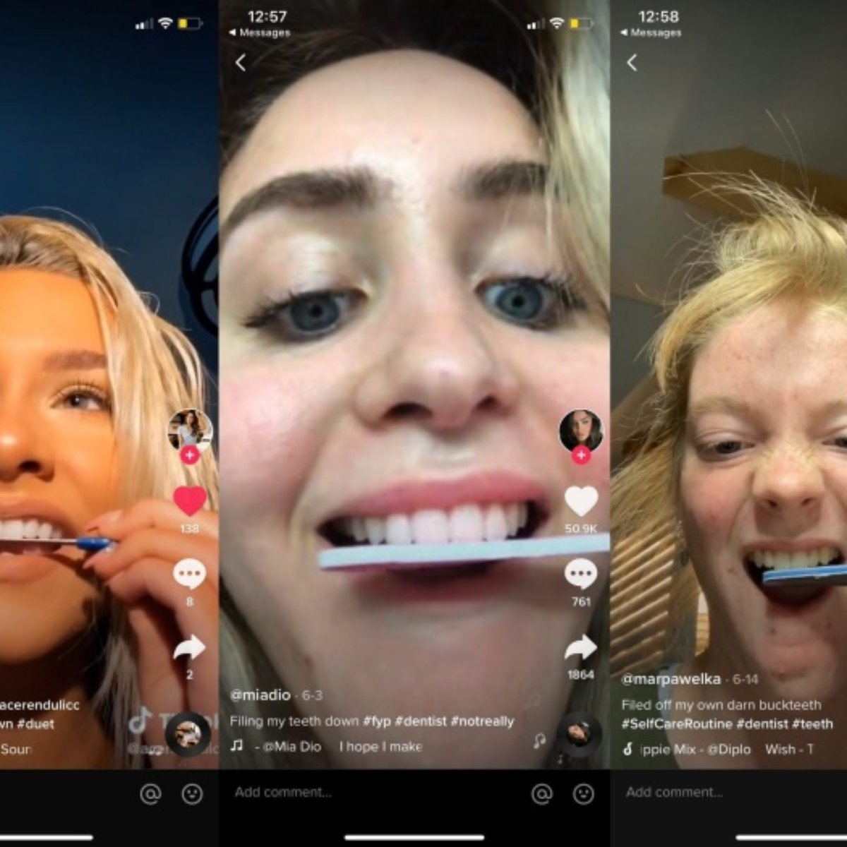 perigo em novo desafio no tiktok jovens lixam os dentes
