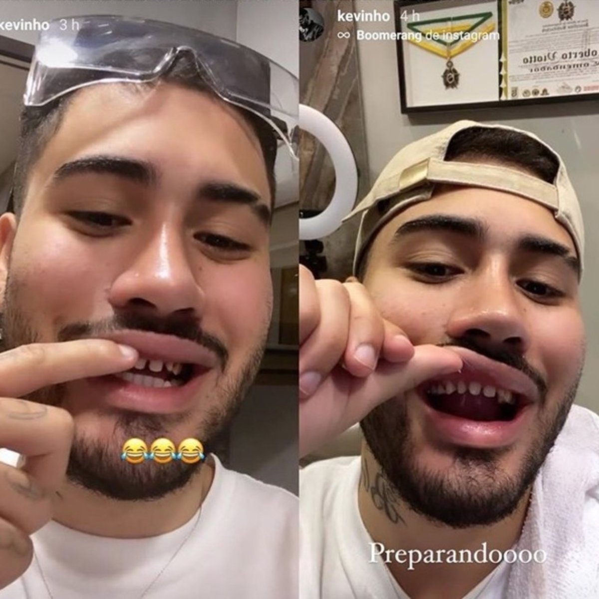 Kevinho Vira Meme Apos Postar Foto Dos Dentes