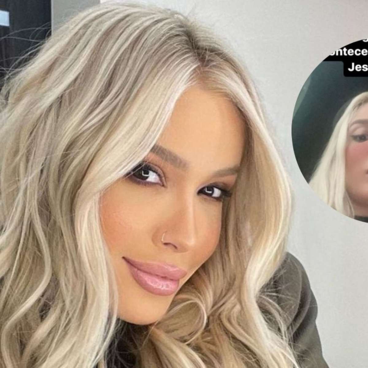 Karoline Lima sofre acidente em carro de aplicativo. Saiba detalhes!