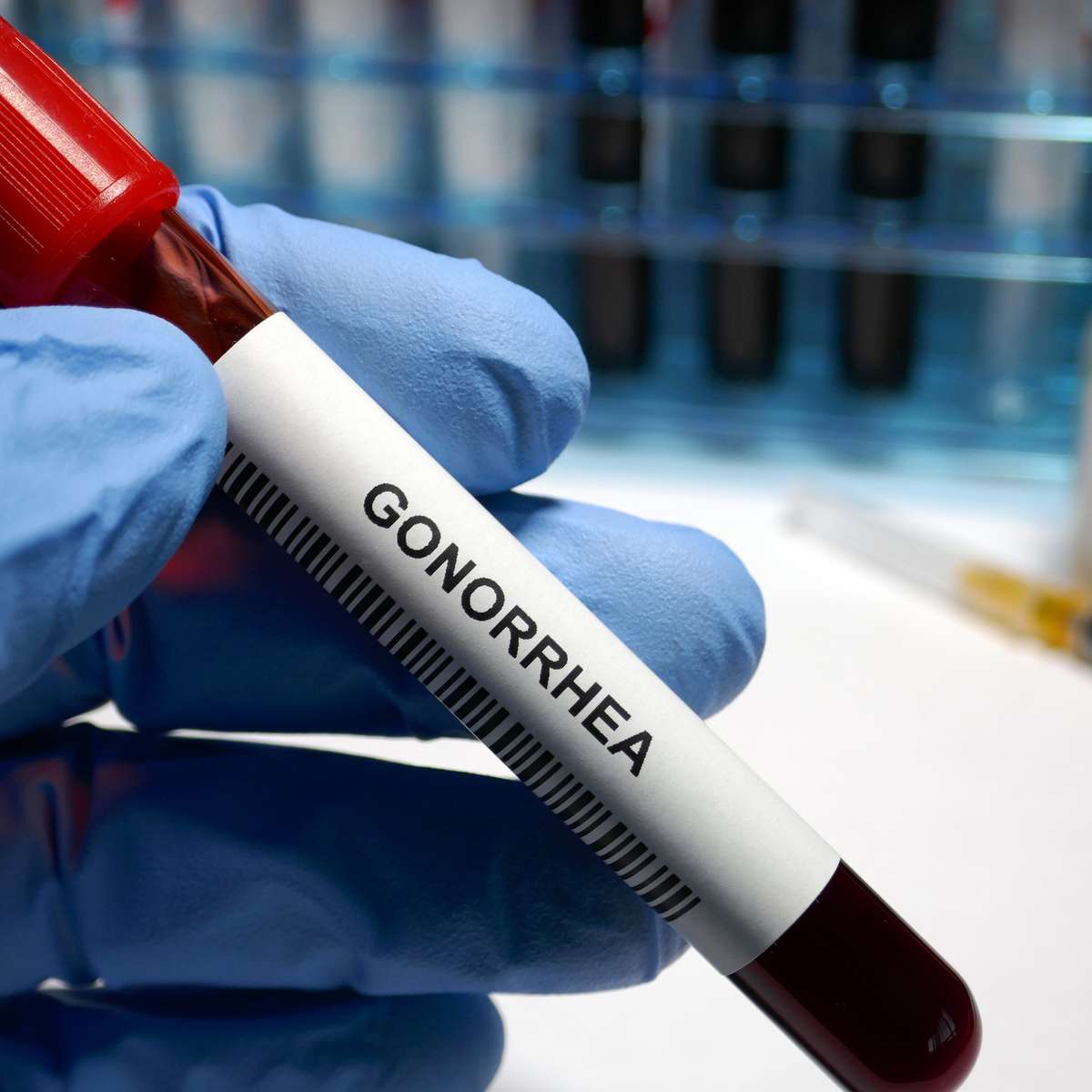 Gonorreia: Como Identificar os Primeiros Sintomas