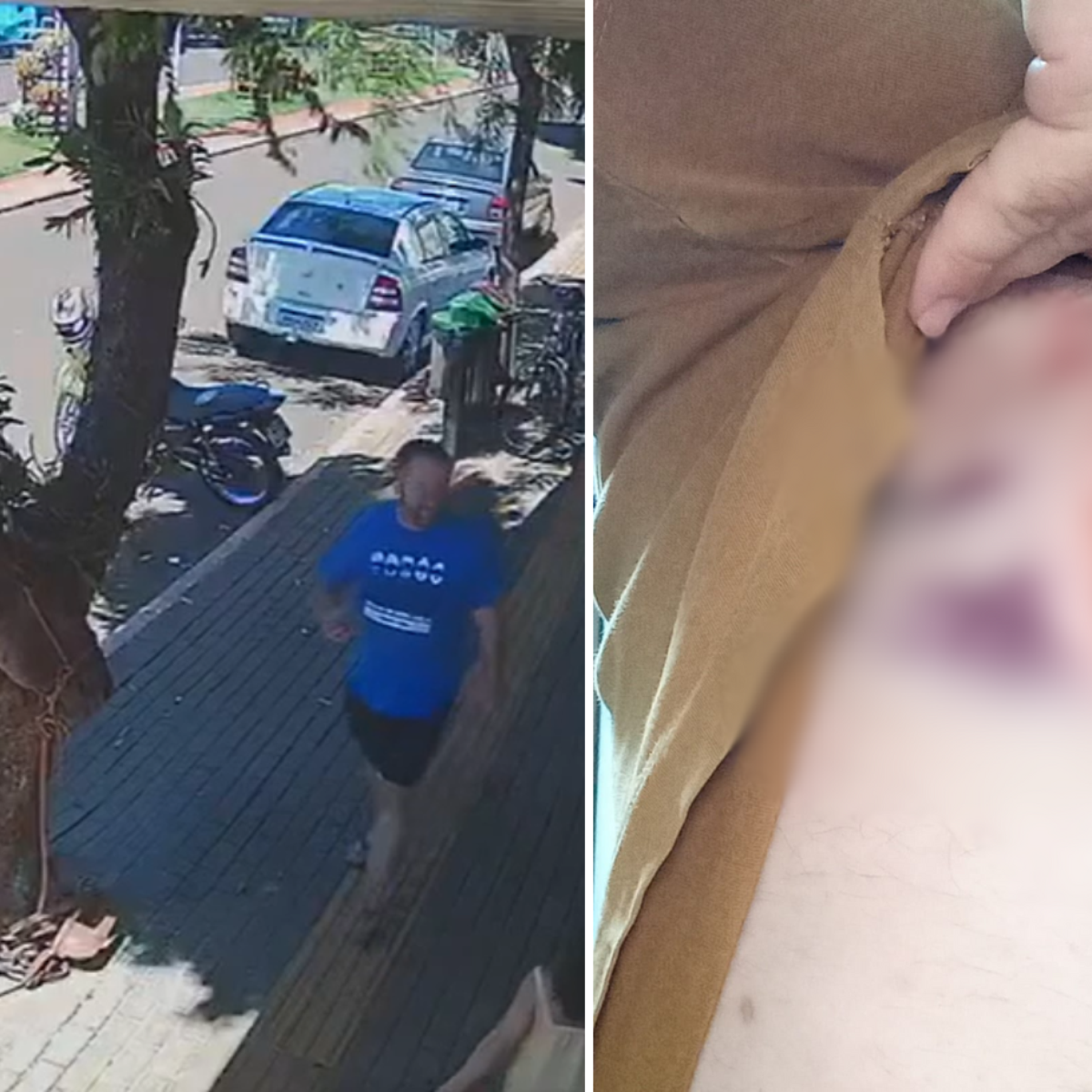 Vereador é surpreendido por mordida de burro na calçada; câmera registrou