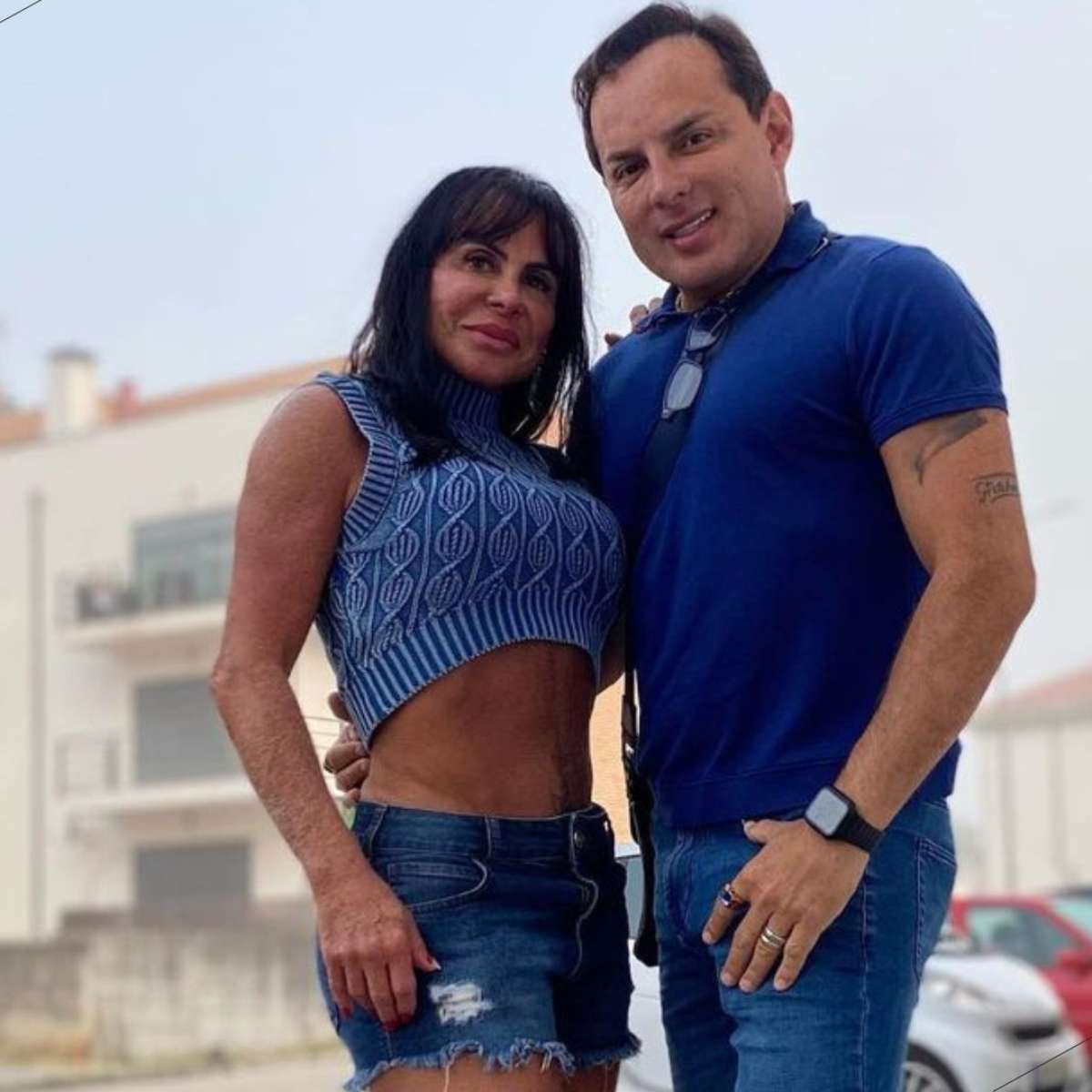 Marido de Gretchen mostra antes e depois de procedimentos estéticos