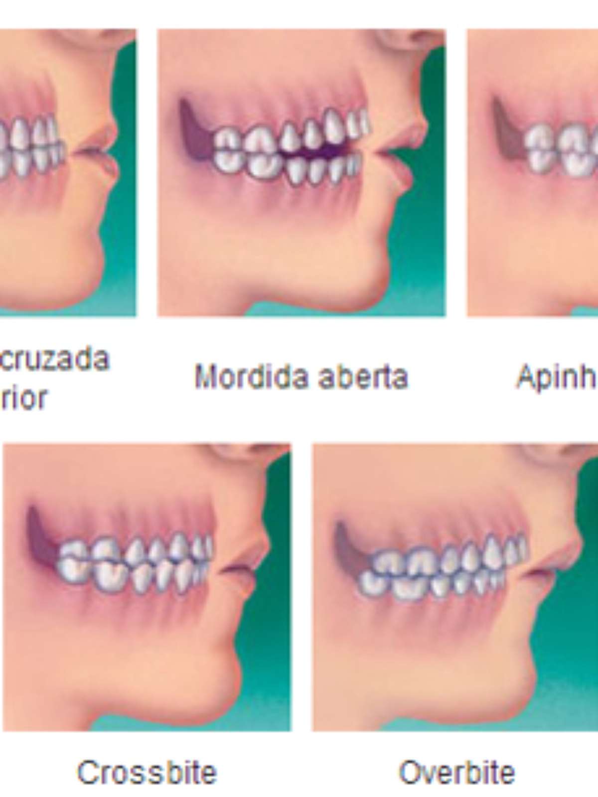 várias bocas em posições diferentes. com dentes, língua, sorriso