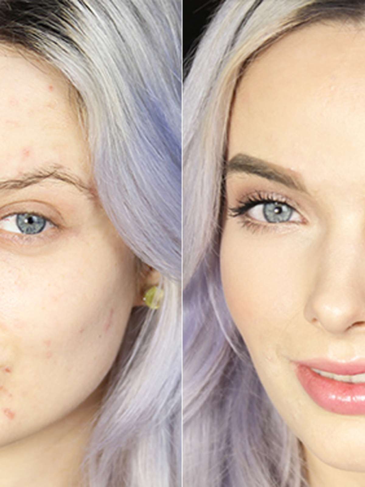 Atriz ensina tutorial perfeito para disfarçar acne com ajuda de