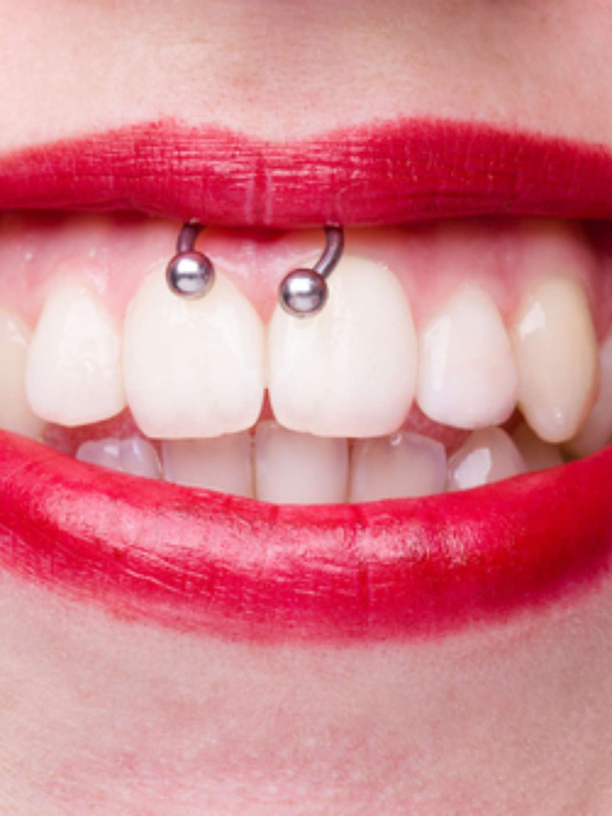 Tenho piercing na língua, posso colocar aparelho nos dentes?