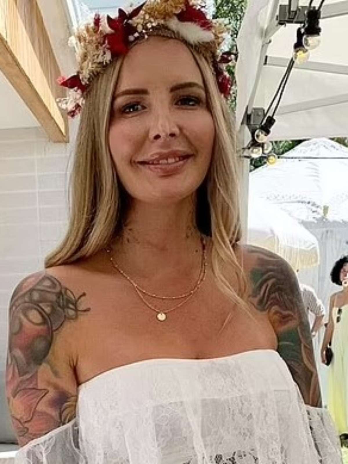 Útero didelfo fotos reais