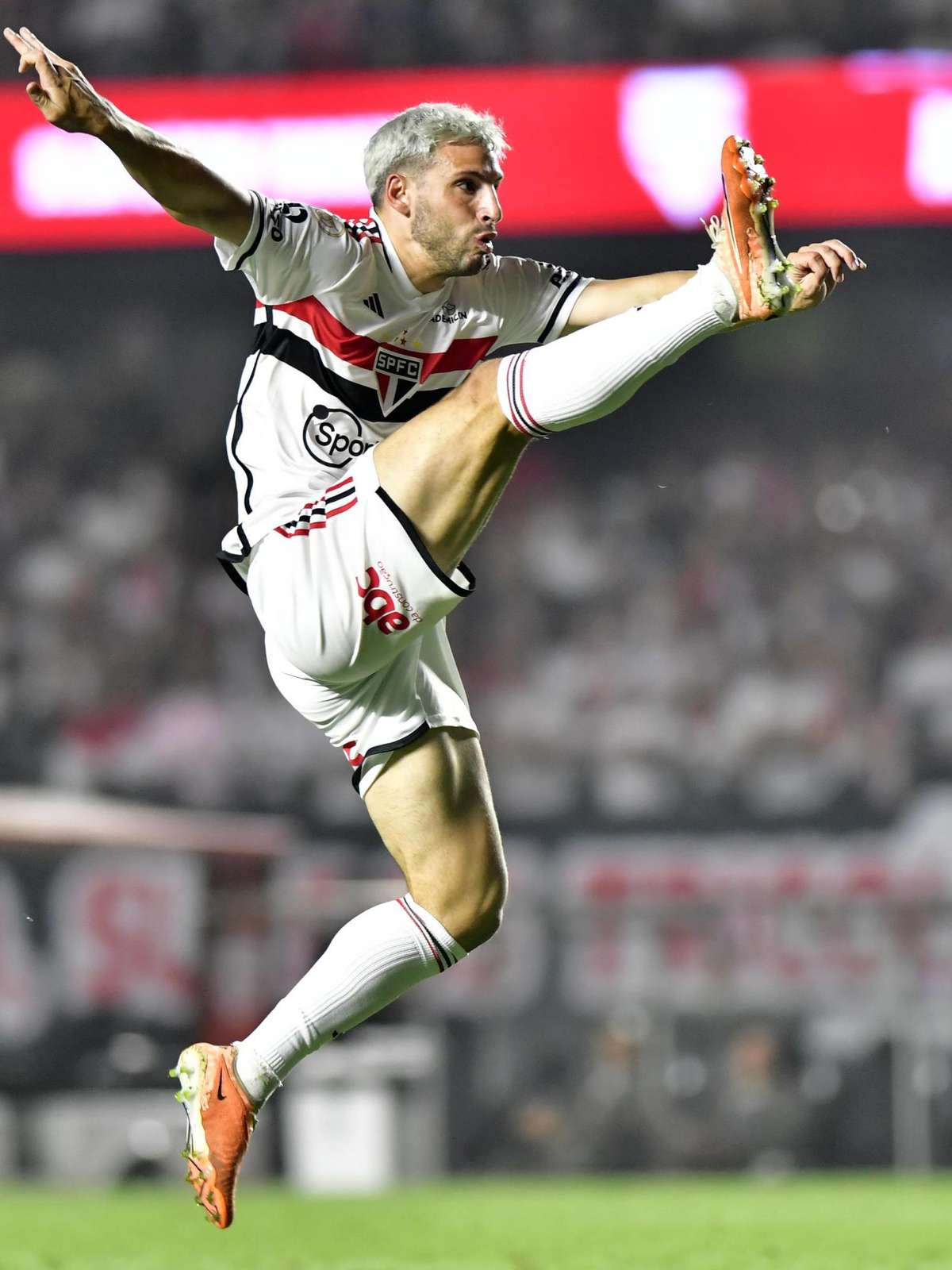 São Paulo estuda recuperação de Calleri, e cirurgia não é descartada