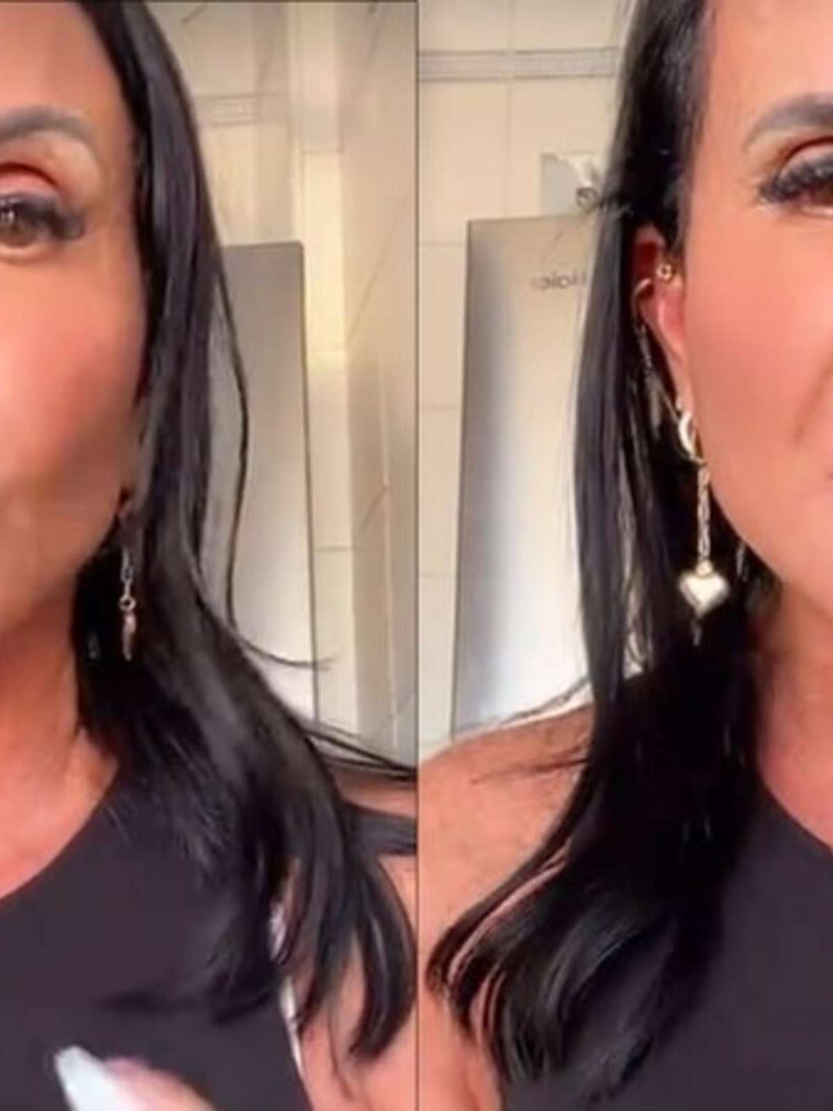 Gretchen rebate críticas por aparecer com pelos nos seios