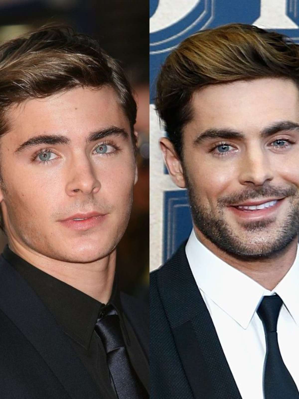 Corpo De Zac Efron Antes E Depois Harmonizações Faciais Que Deram
