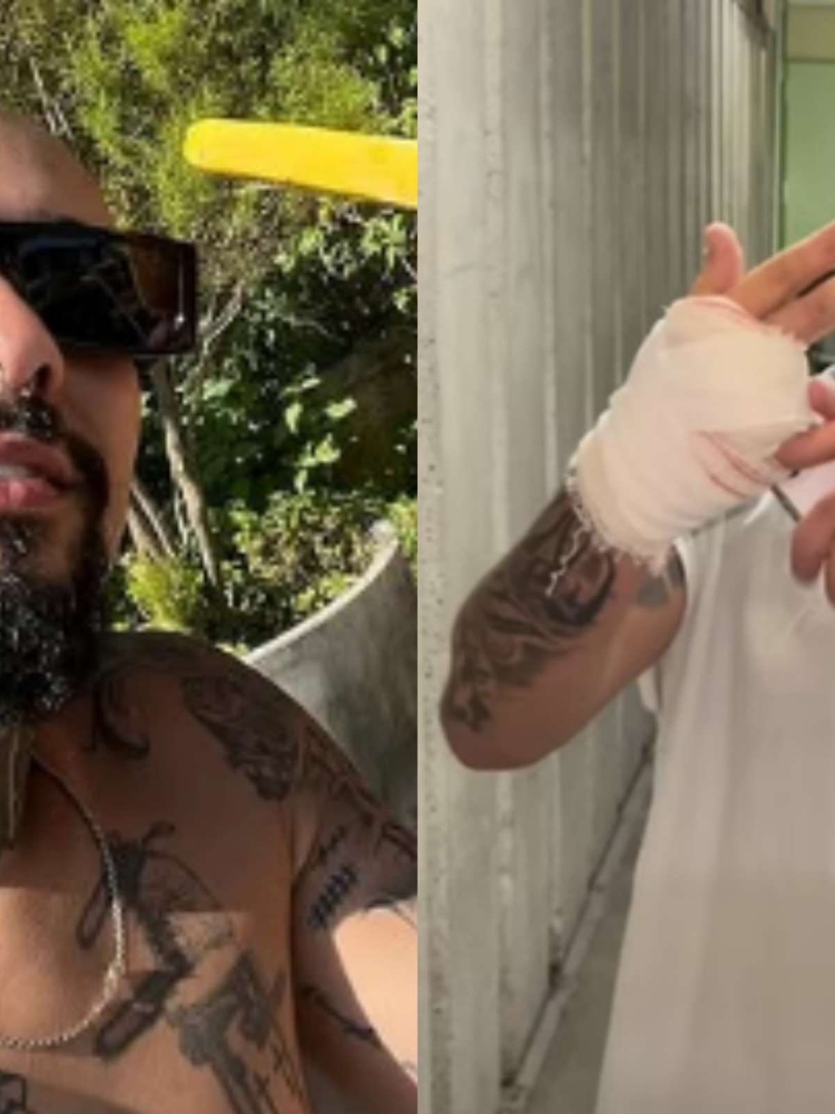 Quem é Lodk, streamer que teve dedo amputado ao tentar invadir o Rock in Rio