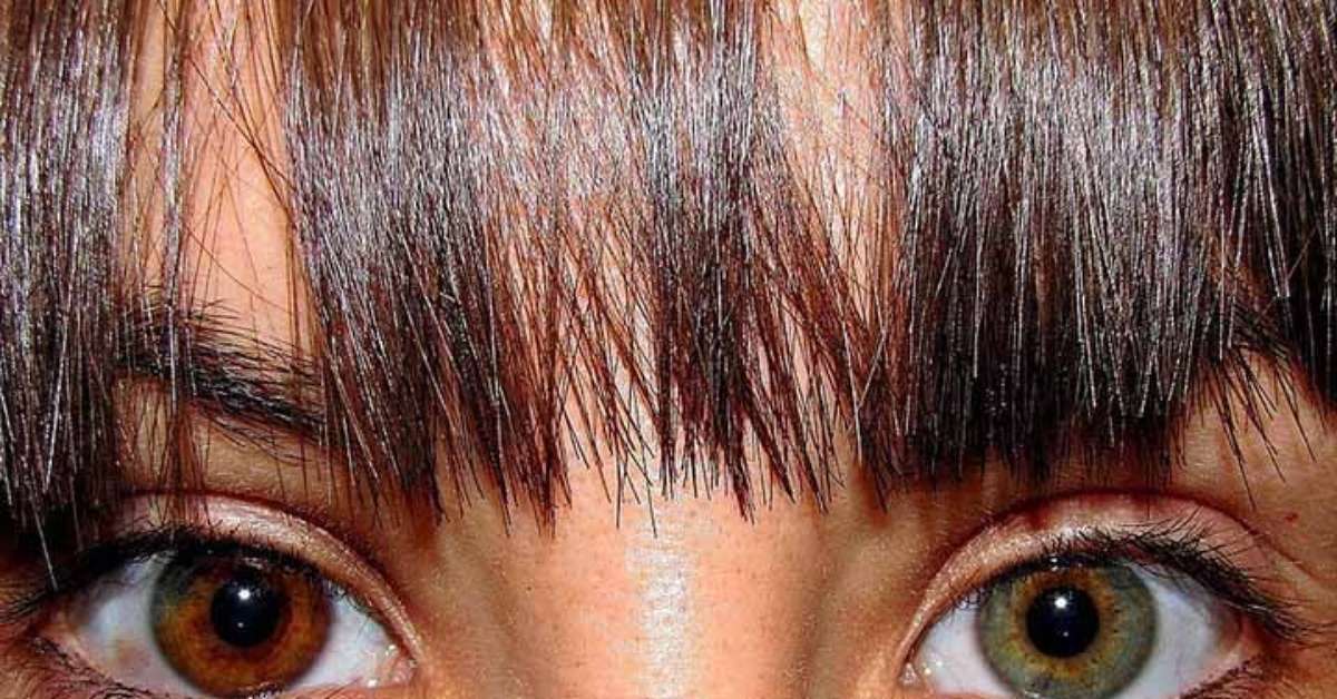 Heterocromia: veja celebridades que apresentam diferenças de cor nos olhos