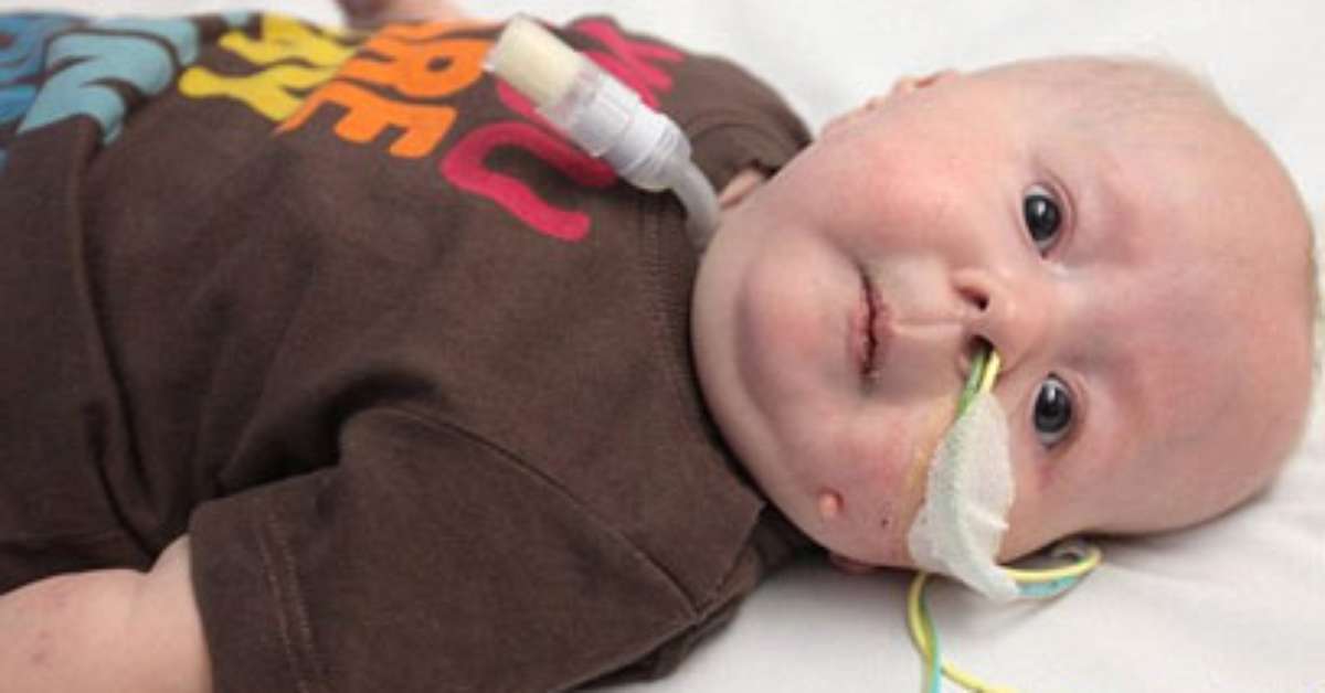 Menina com uma das doenças mais raras passa por 10 cirurgias