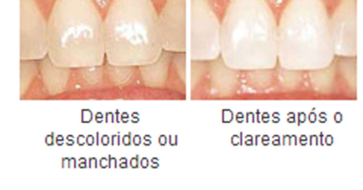 Veja Dicas Para Deixar Seu Sorriso Lindo