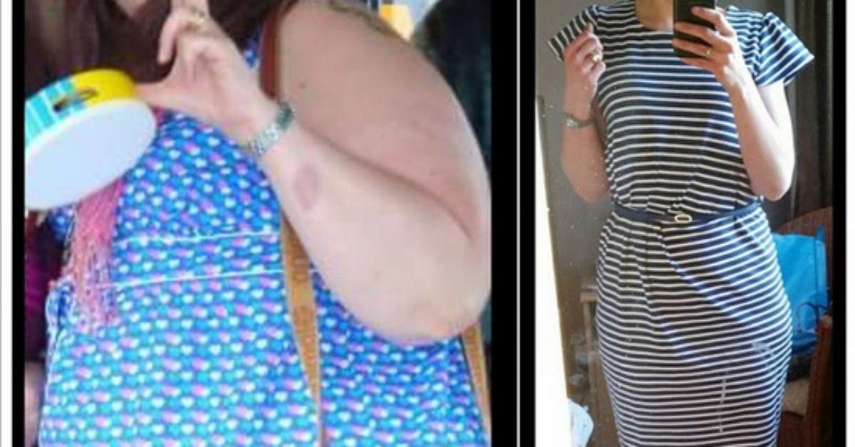 Femeia în vârstă de 42 de ani pierde în greutate