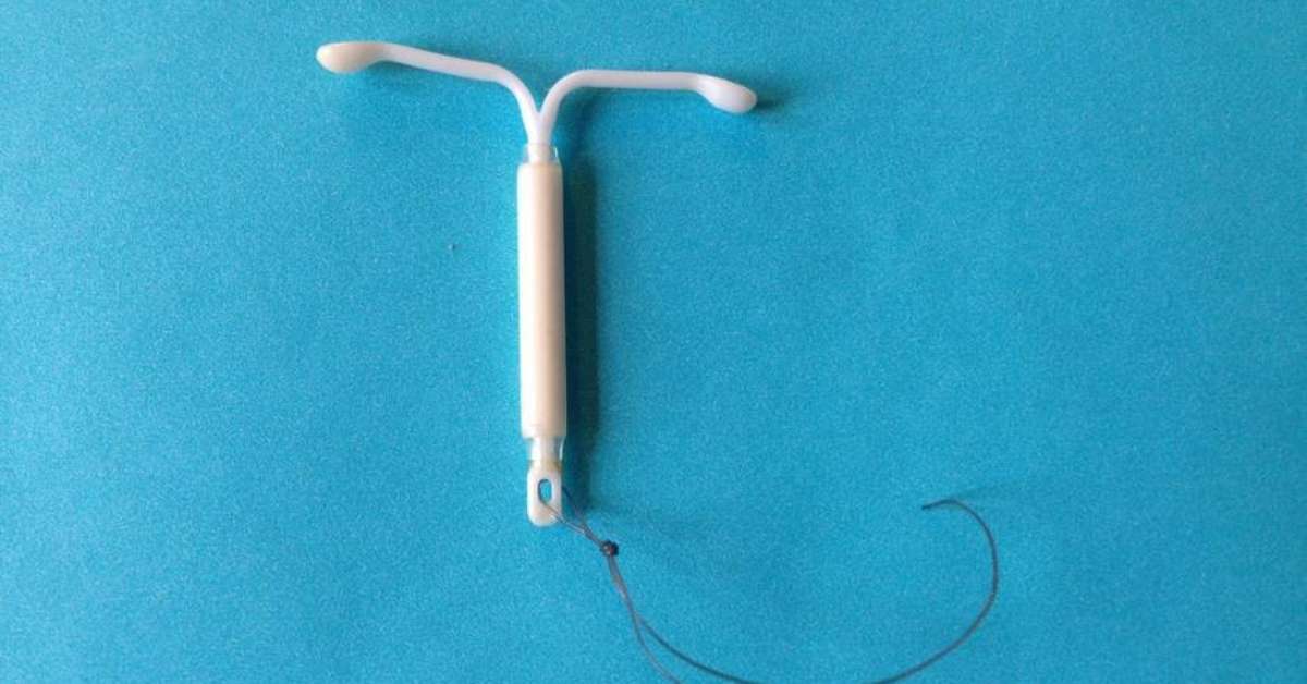 DIU como funciona, as vantagens e desvantagens do método