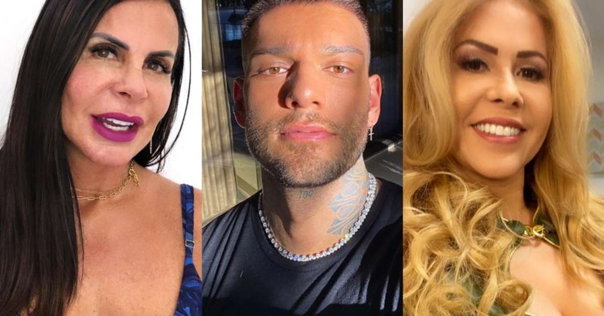 Harmonização facial confira o antes e depois dos famosos