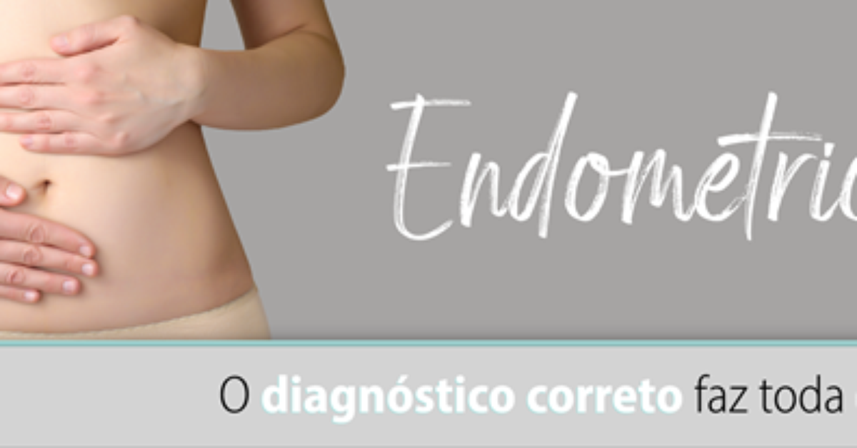 Dia Internacional Da Luta Contra A Endometriose Cerca de 10% das mulheres brasileiras sofrem com a endometriose