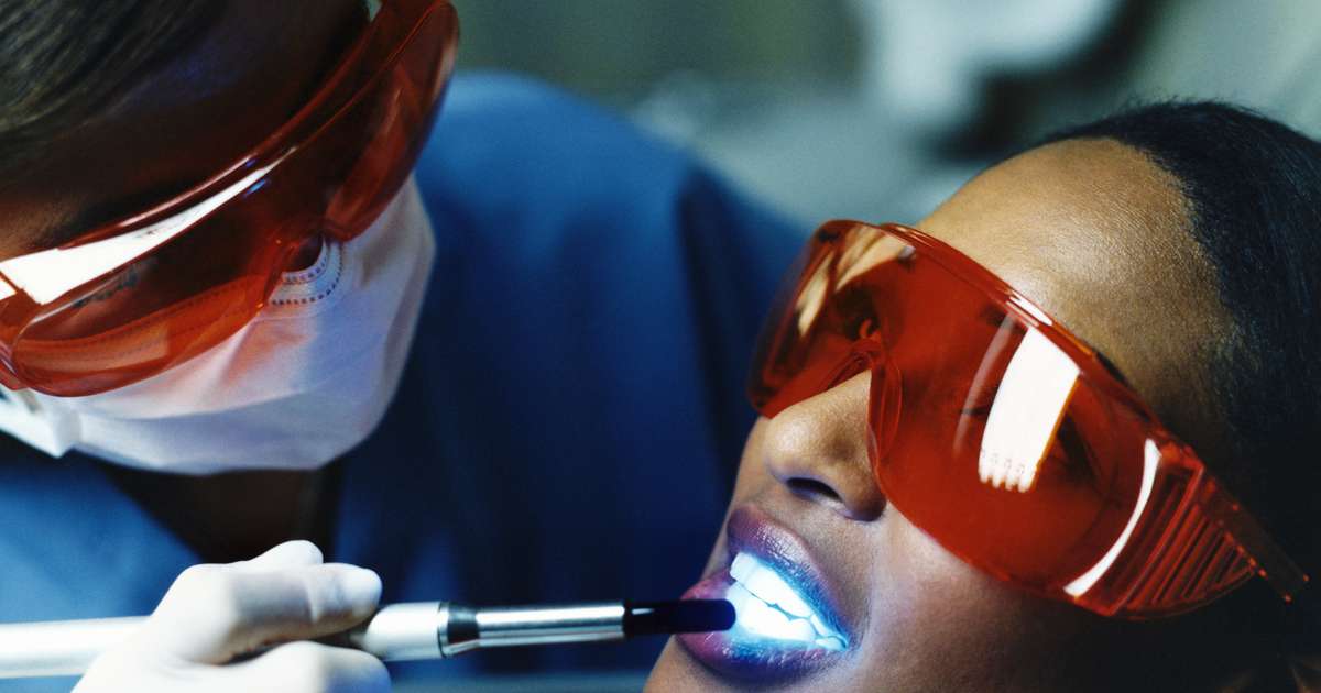 Tres Preguntas Que Debes Saber Responder Sobre El Blanqueamiento Dental