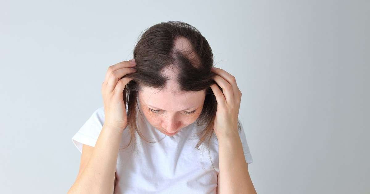 Queda de cabelo pode ser sinal de doença