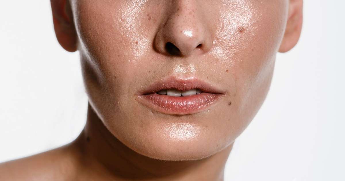 A pele oleosa te causa desconforto? Saiba como diminuir sensa&ccedil;&atilde;o