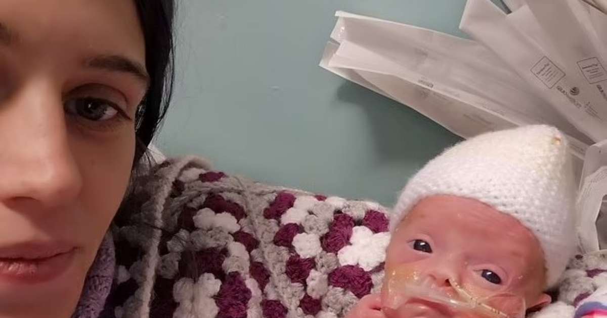 The baby was born at 24 weeks in the UK after being defied by doctors