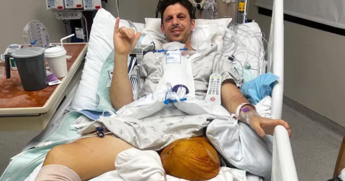 Un padre pierde ambas piernas mientras salva a sus hijas de un accidente con una máquina quitanieves